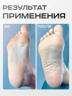 Elnail Pro, Сменные файлы-диски Titan M на мягкой основе 240гр (50 шт)