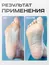 Elnail Pro, Сменные файлы-диски Titan L на мягкой основе 320гр (50 шт)